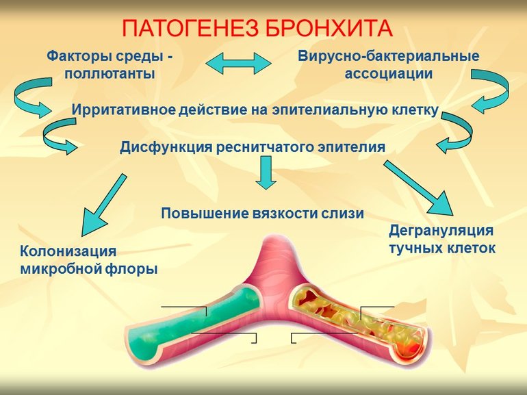 Разница между обструктивной и острой формой бактериального бронхита