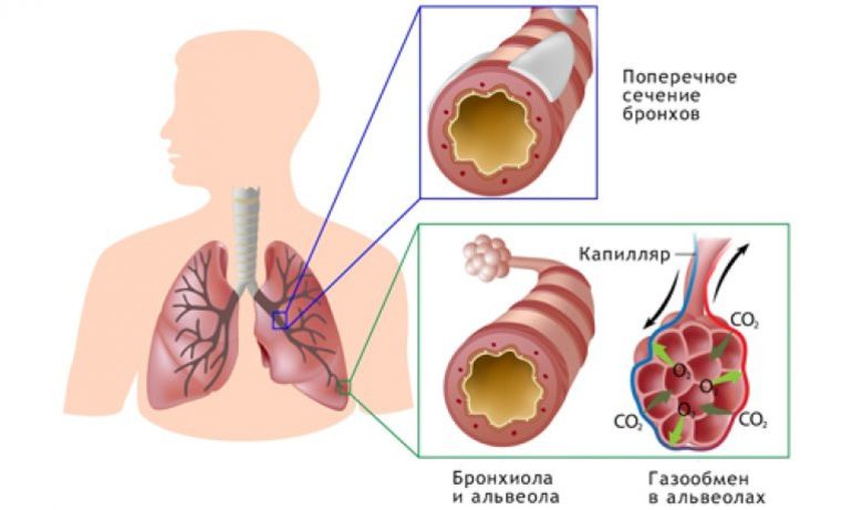 Лечение бронхита
