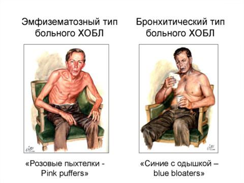 Характерный внешний вид пациентов