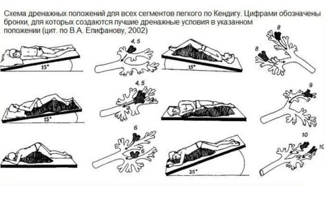 Как облегчить дренирование