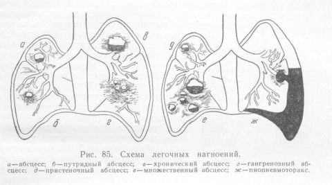 Разные формы патологии